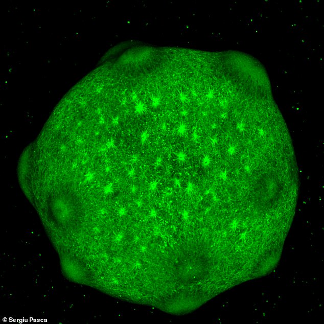 Un organoide cerebral '(en la foto) cultivado a partir de células madre en el laboratorio puede desarrollarse' como un cerebro humano 'y puede ayudar a arrojar luz sobre afecciones como el Alzheimer y la esquizofrenia