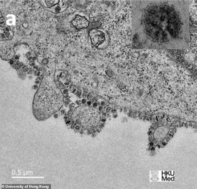 En la imagen, el proceso de gemación del SARS-CoV-2, el virus que causa Covid-19.  Un estudio por computadora encontró que las ondas de ultrasonido entre 25MHz y 100MHz son suficientes para hacer que la célula colapse