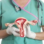 Los exámenes de detección de cáncer de cuello uterino se desploman durante los bloqueos