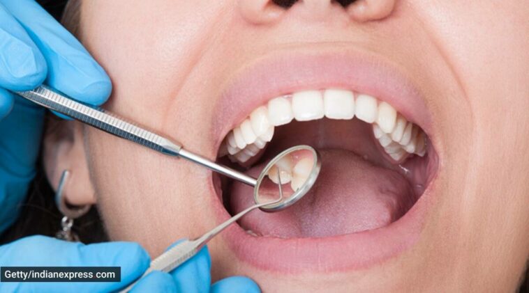 cavities, teeth cavities, cavities in the teeth, oral hygiene, dental health, how to keep teeth healthy, how to prevent cavities, indian express news