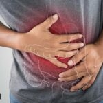 COVID-19, Intestinal gangrene in Covid, what is intestinal gangrene, what causes intestinal gangrene, intestinal gangrene symptoms and treatment, indian express news