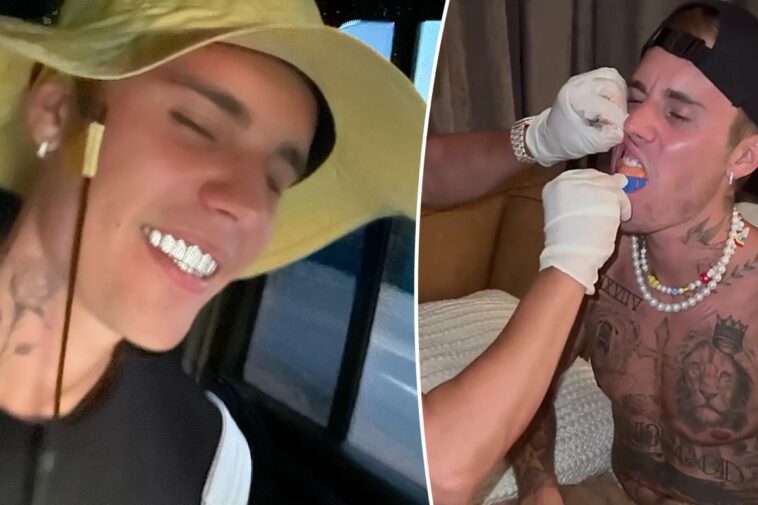 Justin Bieber muestra nuevas parrillas de diamantes en Instagram