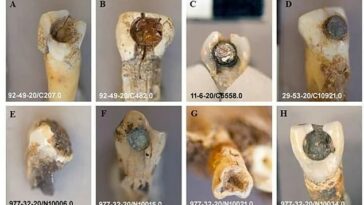 Se analizaron ocho dientes de los antiguos mayas en el estudio que encontró que el sellador utilizado para fijar las piedras preciosas tenía propiedades antibacterianas y antifúngicas.
