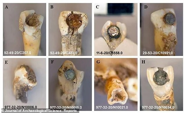 Se analizaron ocho dientes de los antiguos mayas en el estudio que encontró que el sellador utilizado para fijar las piedras preciosas tenía propiedades antibacterianas y antifúngicas.
