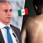 México confirma que su primer caso de viruela símica llegó vía Nueva York