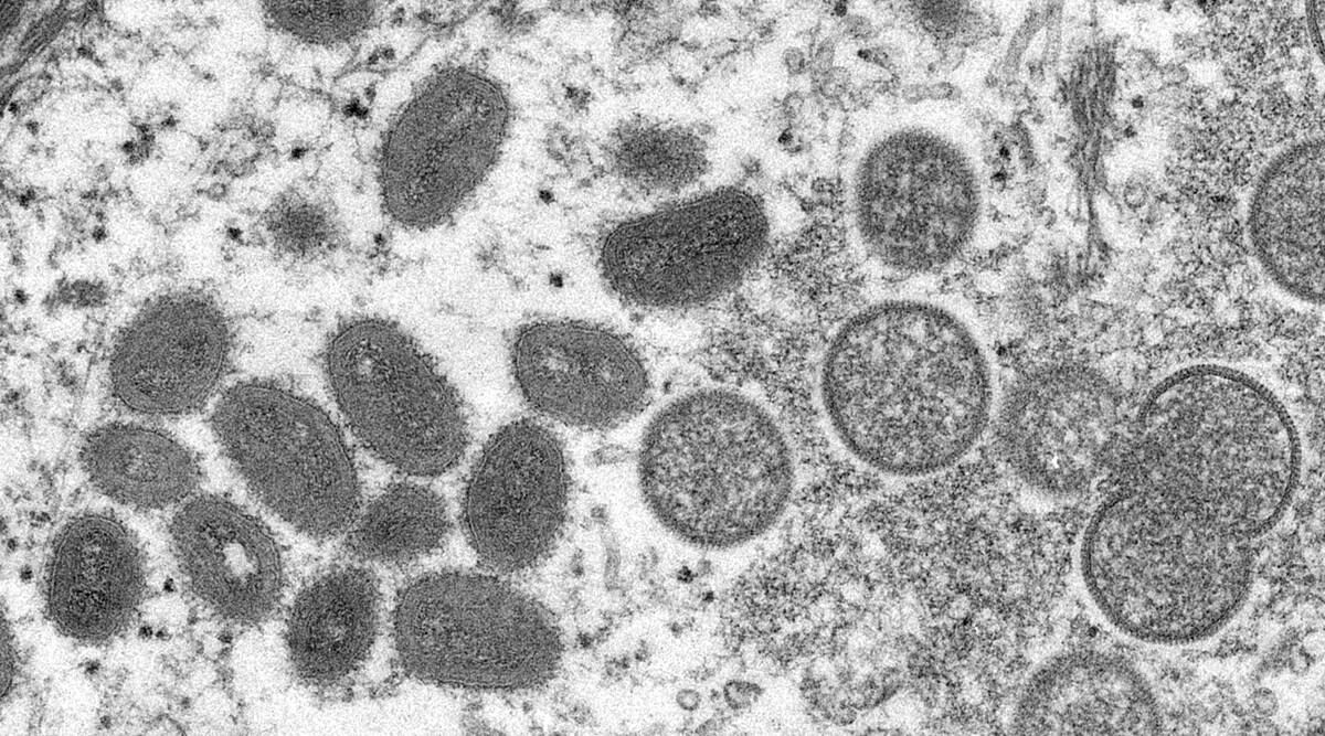 OMS: Casi 200 casos de viruela símica en más de 20 países
