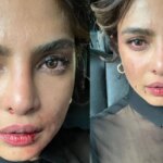 Priyanka Chopra comparte una foto de la cara magullada de los sets de Citadel, los fanáticos preguntan '¿Qué pasó? ¿Estás bien?'.  ver foto