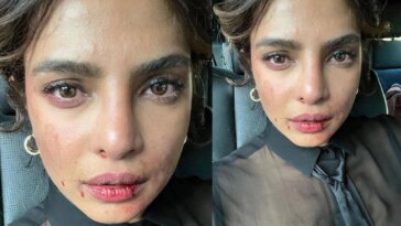 Priyanka Chopra comparte una foto de la cara magullada de los sets de Citadel, los fanáticos preguntan '¿Qué pasó? ¿Estás bien?'.  ver foto