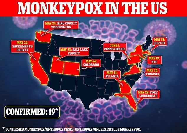 Monkeypox ahora se ha detectado en 19 estados de EE. UU.  Algunos de estos casos solo dieron positivo para los virus de la viruela del simio, una familia que incluye la viruela del simio, pero es muy probable que se confirmen como la enfermedad tropical.