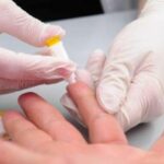 Colombia confirma su primer caso de hepatitis aguda en niños