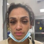Mychelle Johnson publicó imágenes de lesiones en todo su cuerpo, incluida su nariz fracturada el jueves.