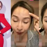 Los internautas piensan que Elva Hsiao, quien reveló que se había sometido a una cirugía plástica antes, recientemente también se operó la nariz