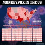 Mujer embarazada da positivo por viruela del mono en Estados Unidos