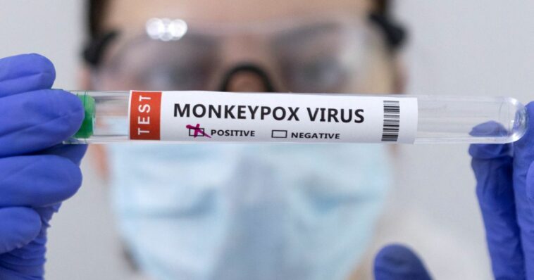 Se necesita una acción 'urgente' en Europa por la propagación de la viruela del simio: OMS