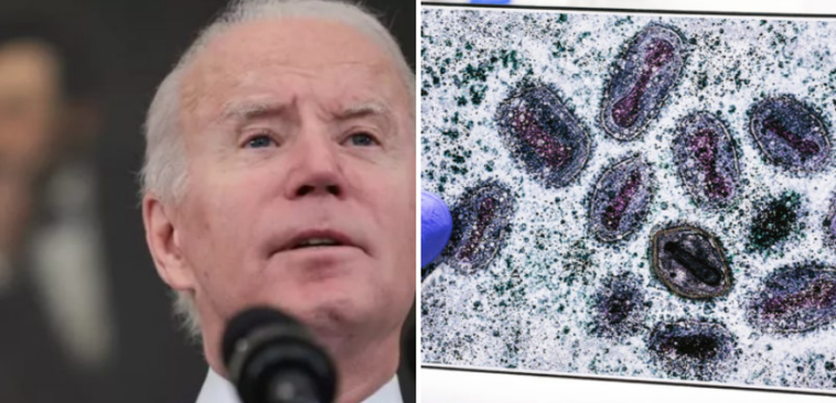 Administración Biden declara emergencia de salud pública por brote de viruela del mono |  La crónica de Michigan