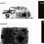 La técnica difiere de las imágenes de rayos X convencionales (centro) en que muestra estructuras microscópicas (derecha)