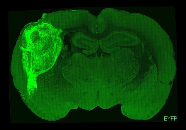 La imagen de arriba muestra un cerebro de rata que ha sido trasplantado con tejido humano (resaltado)