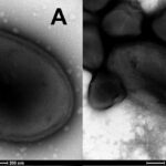El virus de 48.500 años es un pandoravirus, que infecta organismos unicelulares conocidos como amebas.  La imagen A muestra la partícula aislada en forma de huevo de pandoravirus con un pequeño orificio o abertura llamado ostiolo (punta de flecha blanca).  B muestra una mezcla de partículas de pandoravirus y partículas de 'megavirus' con una 'puerta estelar': una estructura blanca similar a una estrella de mar (punta de flecha blanca)