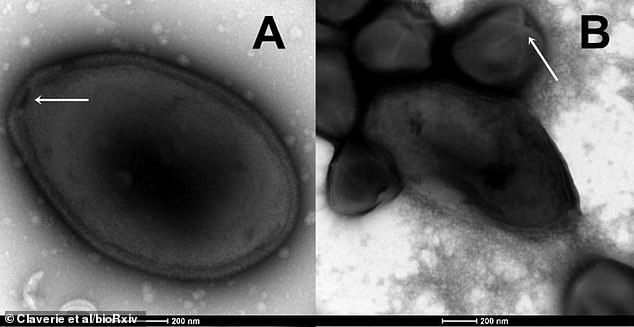 El virus de 48.500 años es un pandoravirus, que infecta organismos unicelulares conocidos como amebas.  La imagen A muestra la partícula aislada en forma de huevo de pandoravirus con un pequeño orificio o abertura llamado ostiolo (punta de flecha blanca).  B muestra una mezcla de partículas de pandoravirus y partículas de 'megavirus' con una 'puerta estelar': una estructura blanca similar a una estrella de mar (punta de flecha blanca)