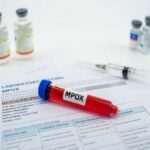 Chile presenta nuevo grupo de riesgo para vacunación contra Mpox