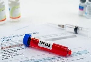 Chile presenta nuevo grupo de riesgo para vacunación contra Mpox