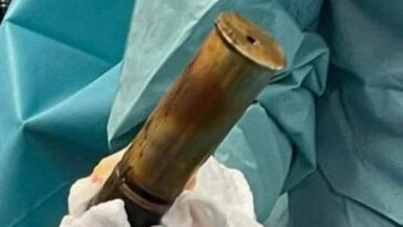 Una vez que se desalojó del recto del hombre, los médicos midieron el caparazón en 8 pulgadas (20 cm) de largo y más de 2 pulgadas (5 cm) de ancho.  El incidente tuvo lugar en el Hospital Sainte Musse en Toulon, sur de Francia, el sábado por la noche.