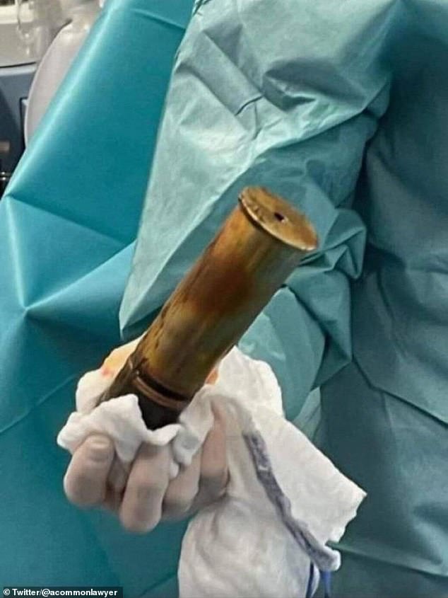 Una vez que se desalojó del recto del hombre, los médicos midieron el caparazón en 8 pulgadas (20 cm) de largo y más de 2 pulgadas (5 cm) de ancho.  El incidente tuvo lugar en el Hospital Sainte Musse en Toulon, sur de Francia, el sábado por la noche.