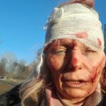 Las fotografías del rostro vendado de Olena Kurylo se vieron en todo el mundo en los primeros días de la invasión de Ucrania por parte de Vladimir Putin.