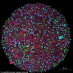 Los científicos revelan un camino revolucionario para impulsar la informática: la inteligencia organoide, en la que los organoides cerebrales creados en laboratorio actúan como hardware biológico.  En la imagen, una imagen ampliada de un organoide cerebral cultivado en laboratorio con etiquetado fluorescente para diferentes tipos de células (las neuronas están sombreadas en rosa)