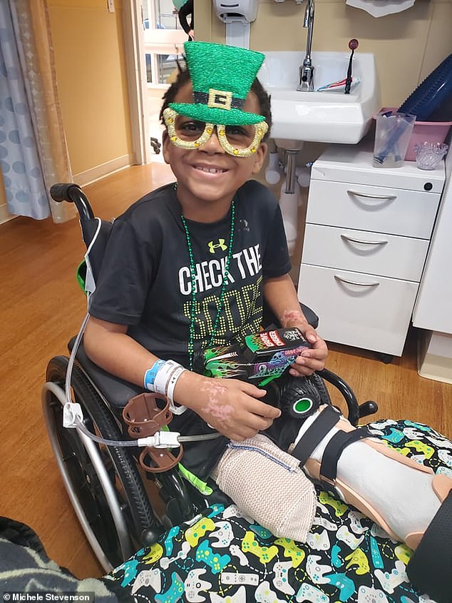 A Kaden Stevenson, de 7 años, de Michigan, le amputaron ambas piernas después de que le diagnosticaran síndrome de shock tóxico.  Le amputaron la pierna derecha por encima de la rodilla y la izquierda por debajo de la rodilla.