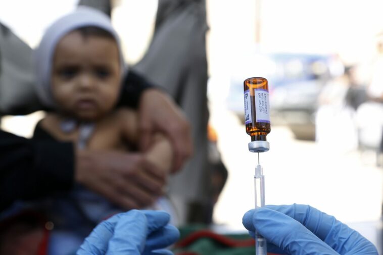 El sarampión se propaga entre los niños en Yemen
