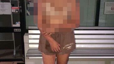 Una niña de 13 años (en la foto después del ataque) supuestamente fue torturada por tres niñas de 12 a 14 años en una casa de Sunshine Coast el sábado 11 de marzo.