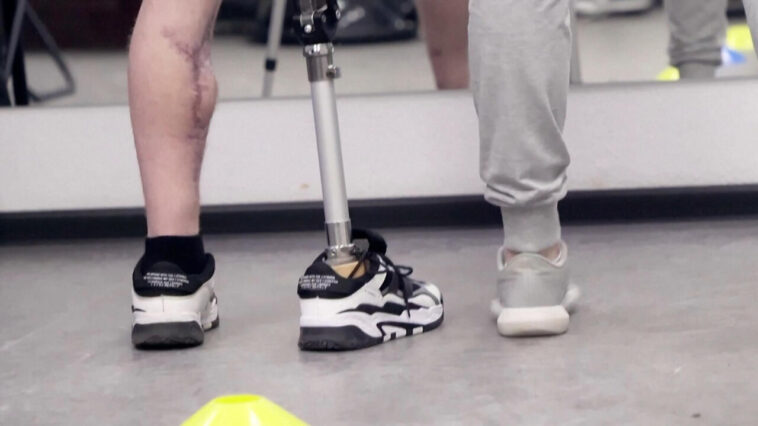 Ucrania: Escasez de prótesis a medida que aumentan las víctimas