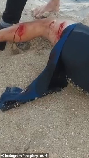 Un surfista atacado por un gran tiburón blanco fue rescatado por otros surfistas, quienes lo arrastraron de regreso a la orilla, solo unas semanas antes de que se lleve a cabo un evento de la gira mundial en la misma playa de Sudáfrica.