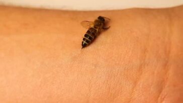 El veneno de la picadura de abeja contiene proteínas que afectan las células de la piel y el sistema inmunológico, causando dolor e inflamación alrededor del área de la picadura (Imagen de archivo)