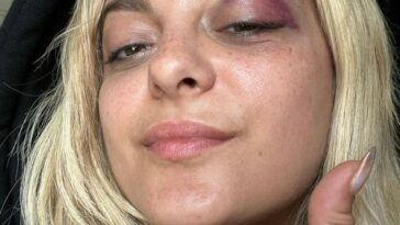 Bebe Rexha está 'bien' tras recibir un golpe en la cara en pleno concierto