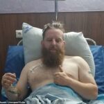 James Smith (en la foto), de 33 años, de Eastham en Wirral, pisó una mina terrestre rusa mientras estaba en el sur de Ucrania el domingo 18 de junio y ahora se está recuperando en el hospital.