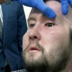 Los cirujanos realizan por primera vez en el mundo un trasplante de un ojo humano completo