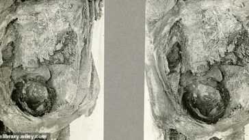 Los arqueólogos encontraron la cabeza de un bebé dentro de la pelvis de una mujer momificada que murió durante el parto en el antiguo Egipto.  El equipo cree que el bebé fue decapitado accidentalmente.