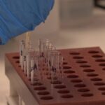 Nueva prueba de "compatibilidad sanguínea" de células falciformes para reducir los efectos secundarios del tratamiento