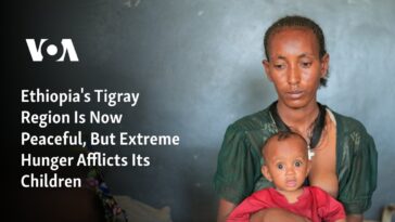 La región etíope de Tigray es ahora pacífica, pero el hambre extrema aflige a sus niños