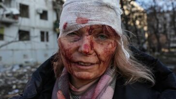 Ensangrentada y vendada, Olena Kurylo (en la foto) se convirtió en el rostro de la guerra de Ucrania después de la invasión inicial de Rusia a principios de 2022.
