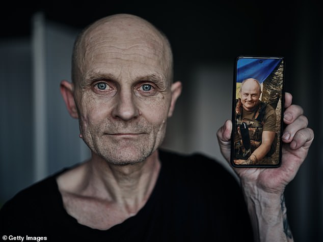 Uno de los soldados apenas es reconocible en una fotografía de lado a lado que lo muestra antes y después de su cautiverio.