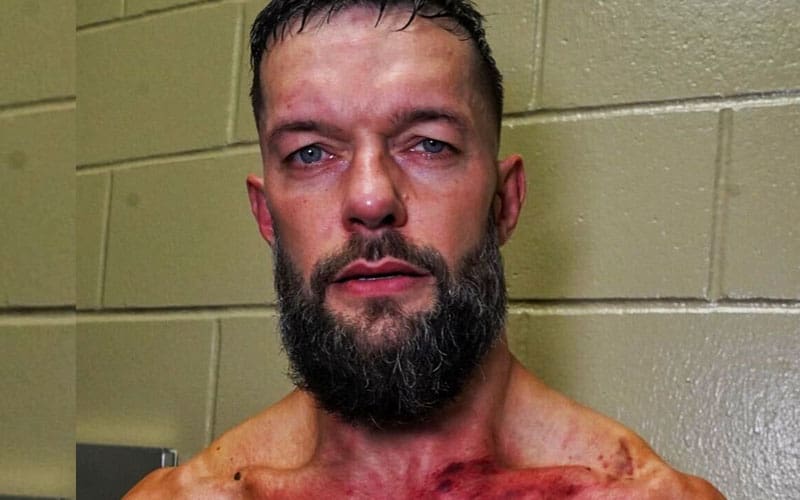 Finn Balor muestra las brutales consecuencias de la ofensiva de GUNTHER después del 29 de julio en WWE RAW
