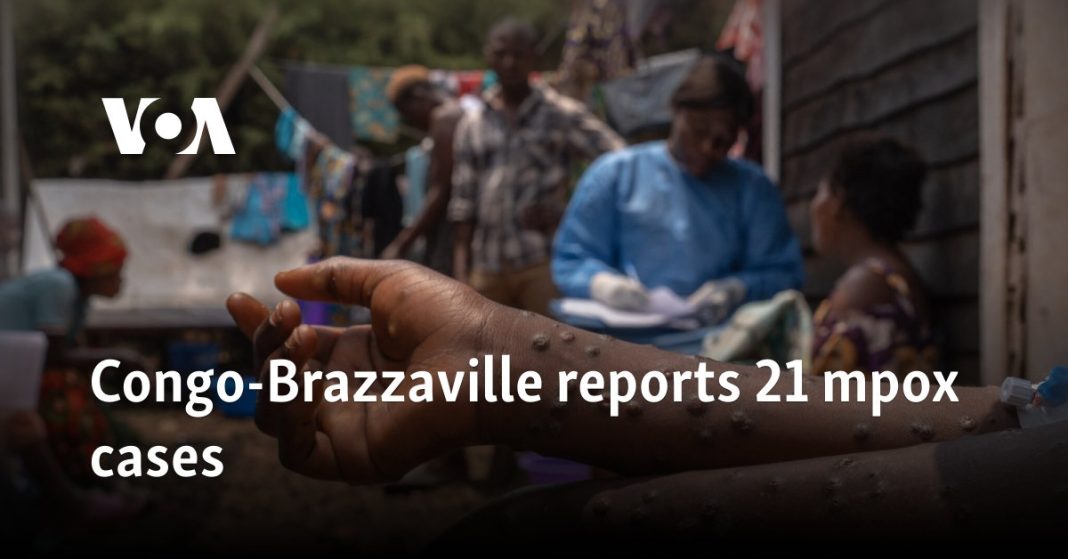 Congo-Brazzaville reporta 21 mpox de casos
