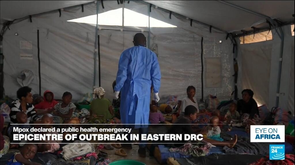 FRANCE 24 informa desde el epicentro del brote de Mpox en el este de la República Democrática del Congo
