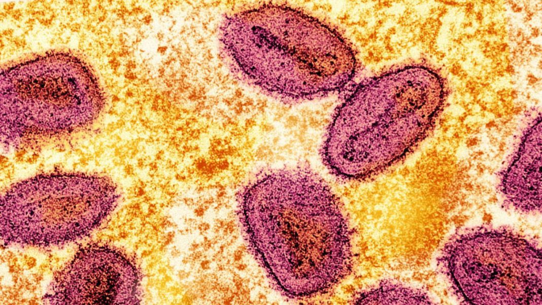 Filipinas detecta el primer caso de mpox este año, pero aún no se ha determinado la cepa
