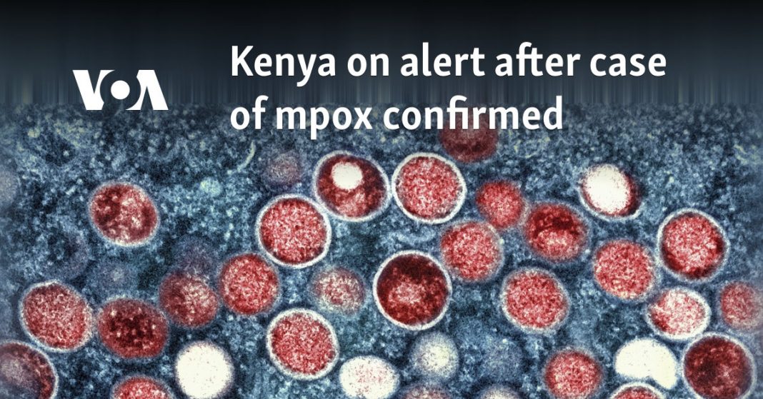 Kenia en alerta tras confirmarse caso de mpox
