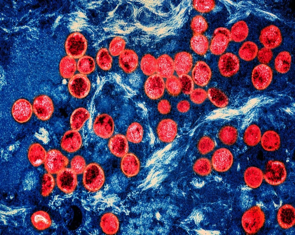 The Africa CDC has declared mpox a Public Health Emergency of Continental Security. (NIH-NIAID/IMAGE POINT FR/BSIP/Universal Images Group via Getty Images)