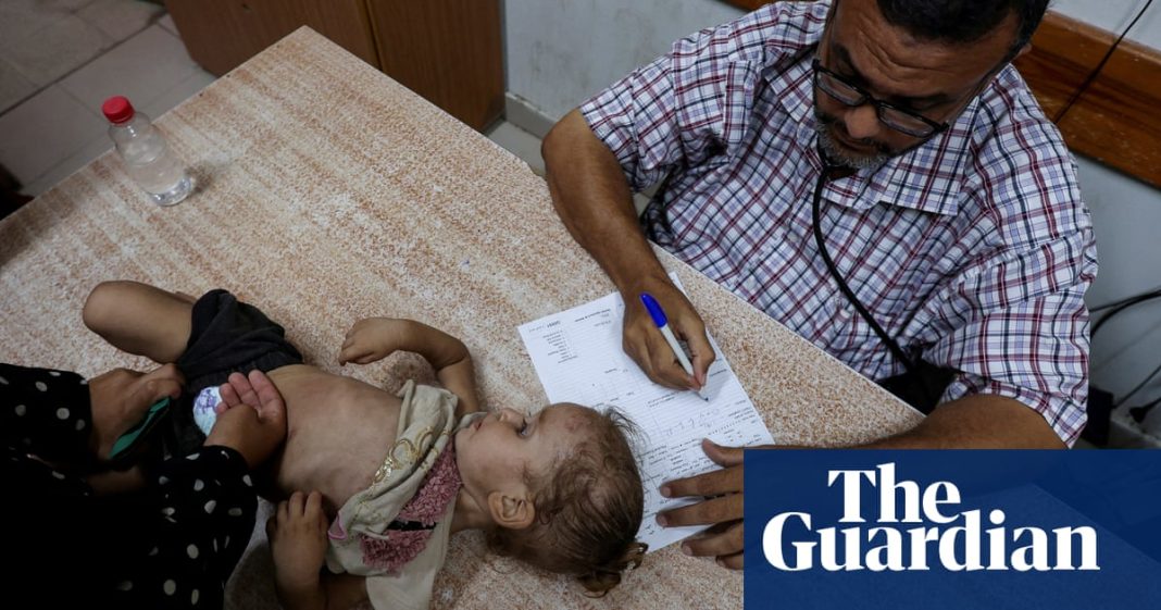 Un bebé en Gaza quedó parcialmente paralizado por la polio, el primer caso en el territorio en 25 años
